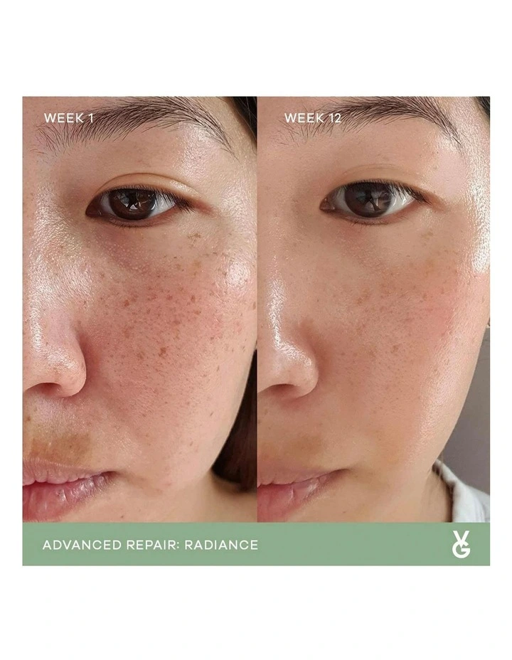 Discount β€οΈ Vida Glow Radiance Supplement π 3 Discount β€οΈ Vida Glow Radiance Supplement π - Image 3