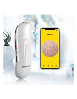 Discount ❤️ Deen Smart K20 Visual Pore Cleaner Device 🔔 -Gtsare Sales Store unnamed file 1177